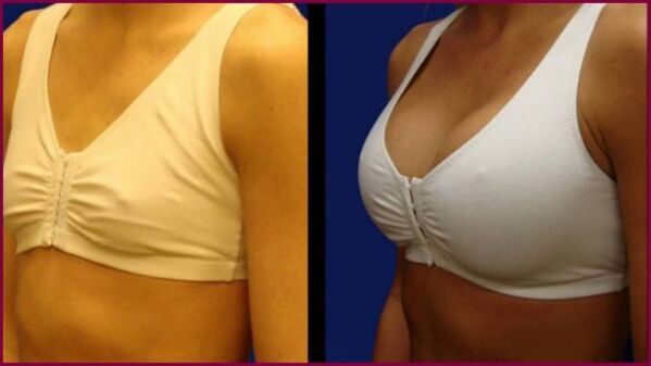 antes e depois