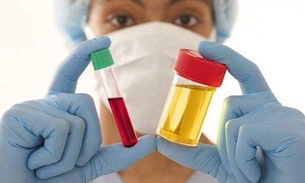 exames de sangue e urina antes da cirurgia de aumento de mama